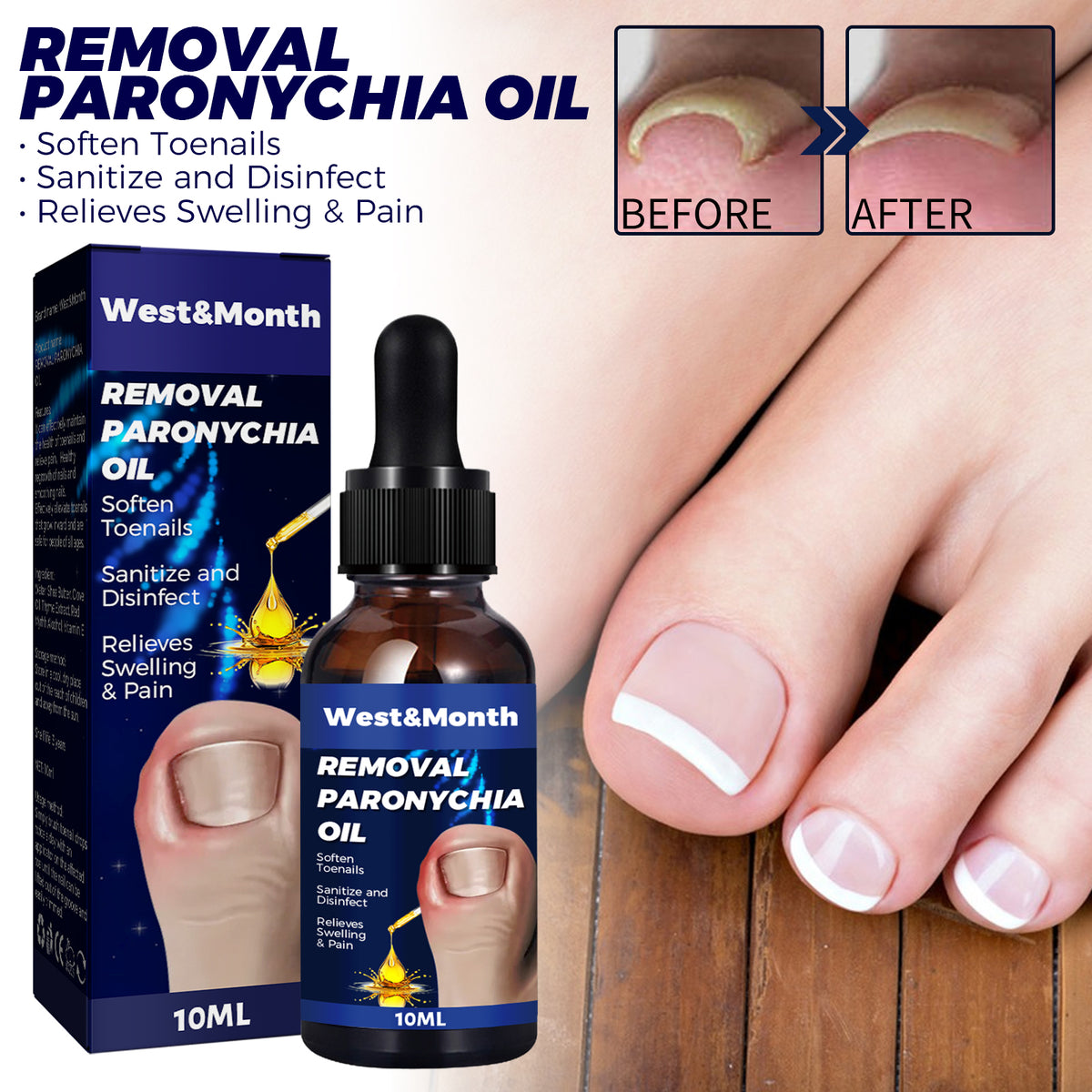 Nail Repair Oil Hand And Foot Repair Inlaid Toenails Soft Nails Daily Moisturizing Nail Care
