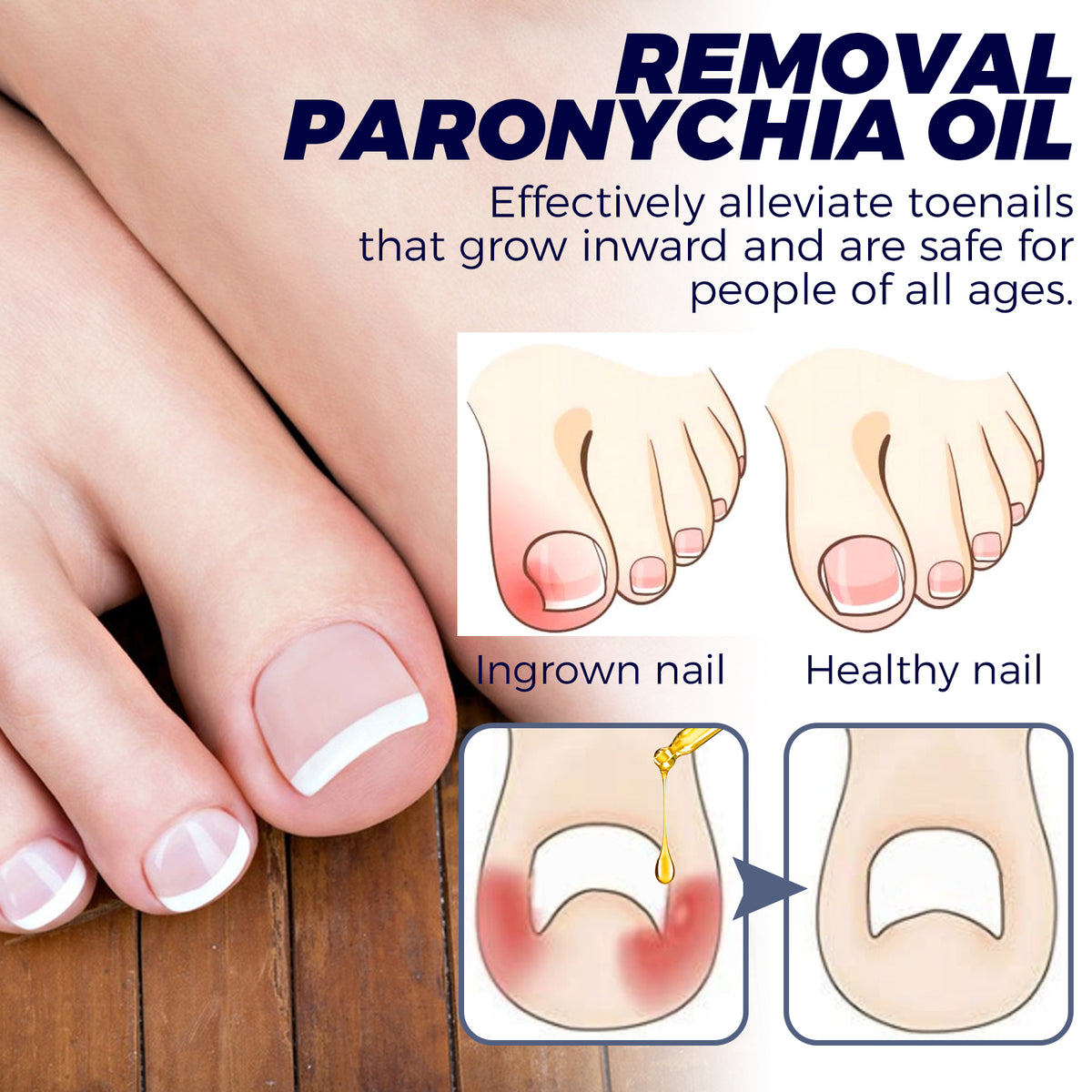 Nail Repair Oil Hand And Foot Repair Inlaid Toenails Soft Nails Daily Moisturizing Nail Care